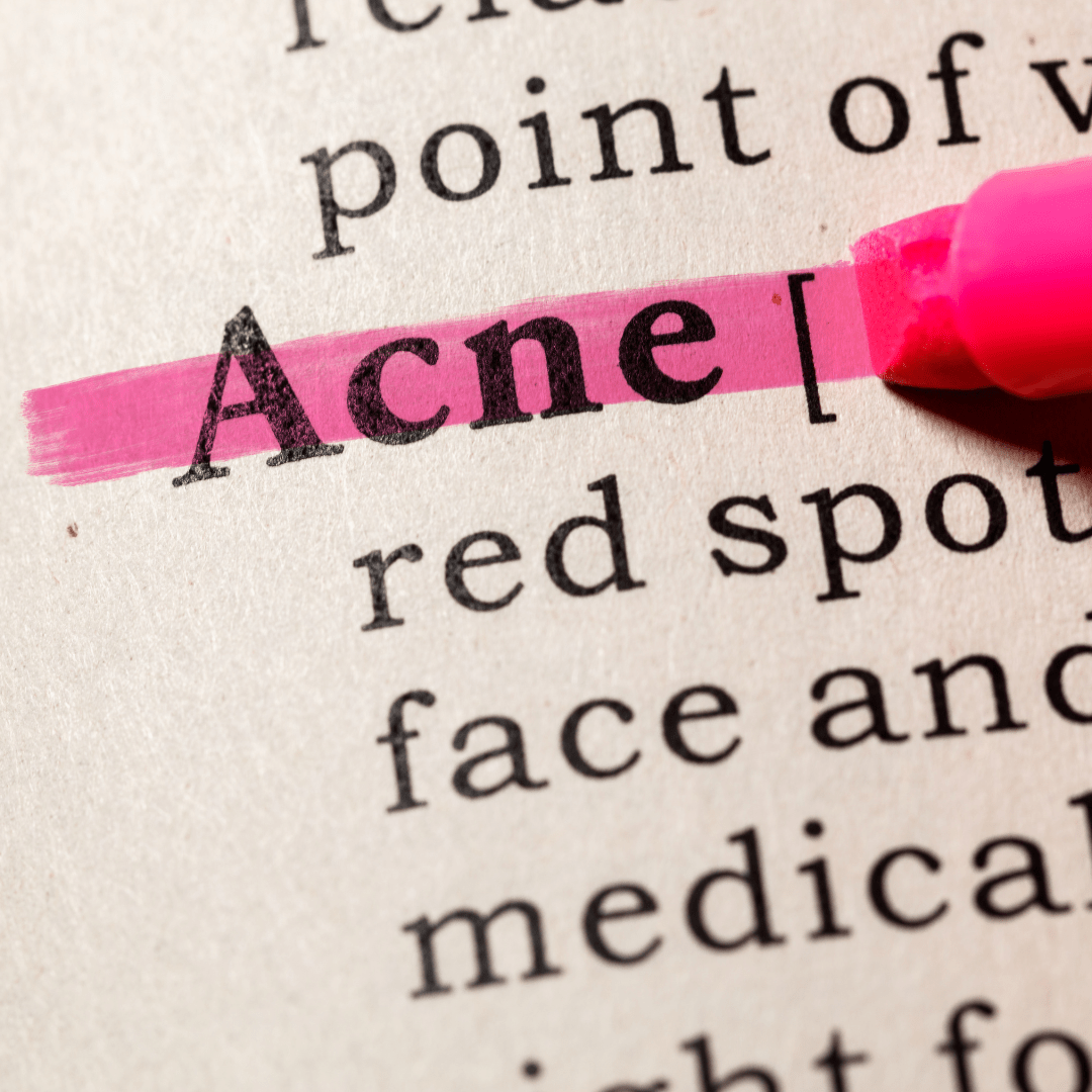 Acne-Prone Skin- Dos and Don'ts for Clearing and Preventing Breakouts - Rena Roots™