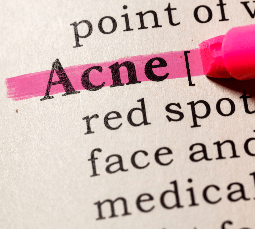 Acne-Prone Skin- Dos and Don'ts for Clearing and Preventing Breakouts - Rena Roots™