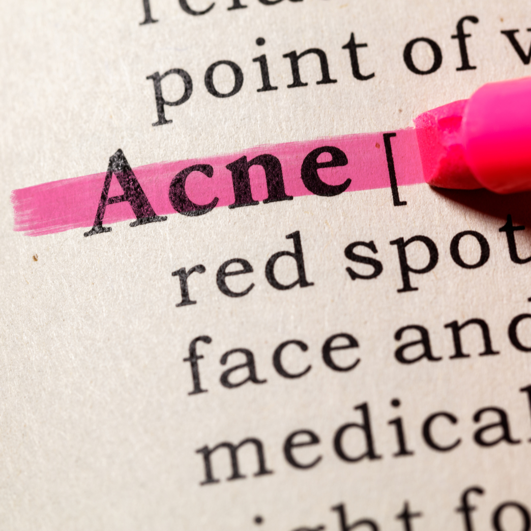 Acne-Prone Skin- Dos and Don'ts for Clearing and Preventing Breakouts