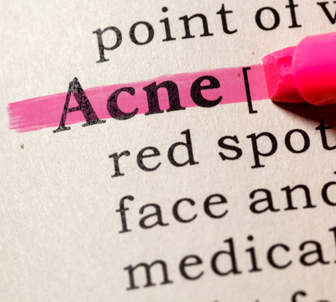 Acne-Prone Skin- Dos and Don'ts for Clearing and Preventing Breakouts