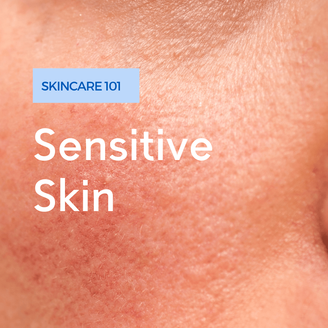 Sensitive Skin: Understanding Your Skin Type and Navigating the Skincare World - Rena Roots™
