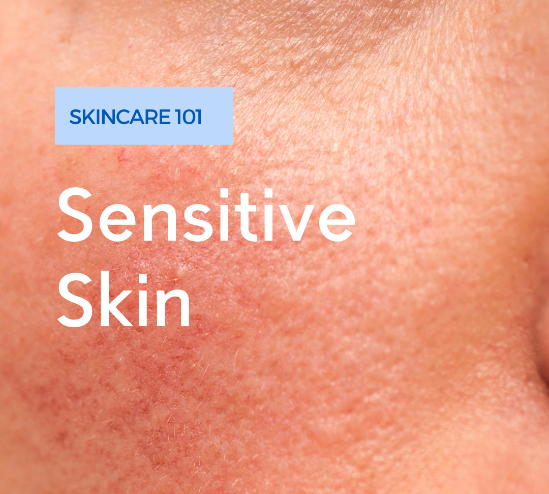 Sensitive Skin: Understanding Your Skin Type and Navigating the Skincare World