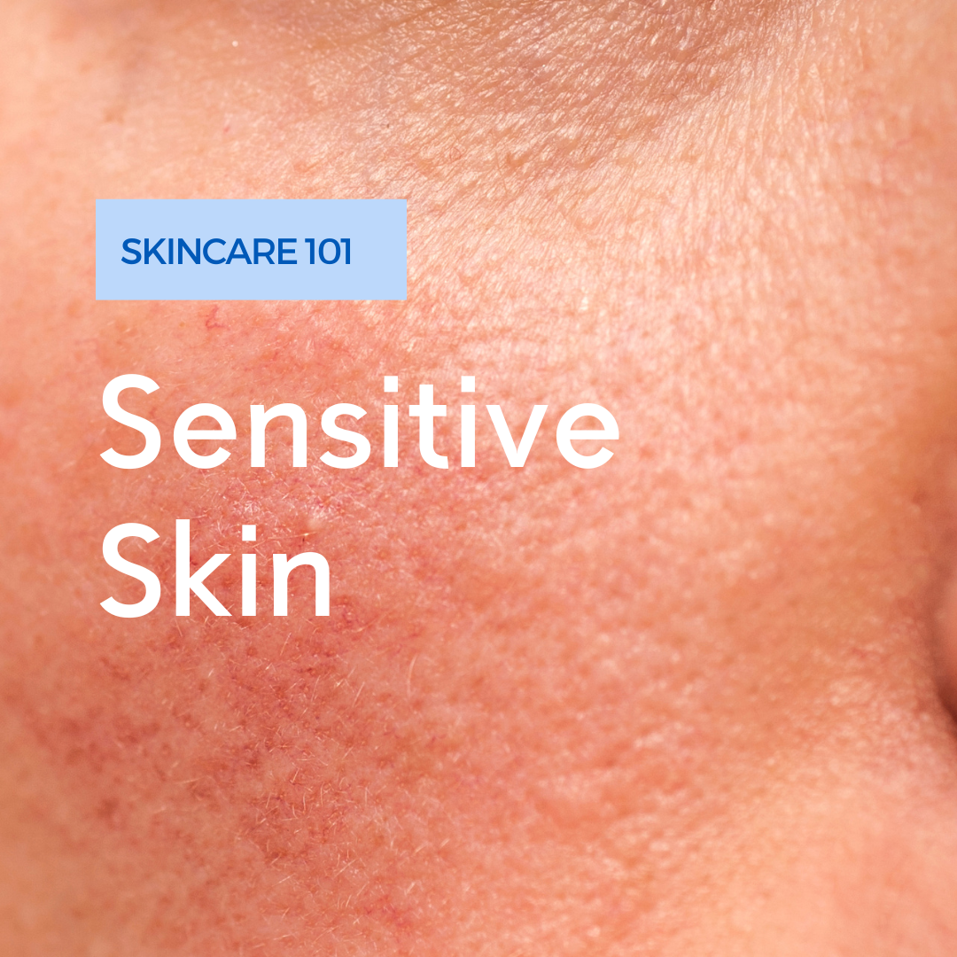Sensitive Skin: Understanding Your Skin Type and Navigating the Skinca