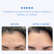 Albanian Immortelle Serum - Rescue Drops - Rena Roots™