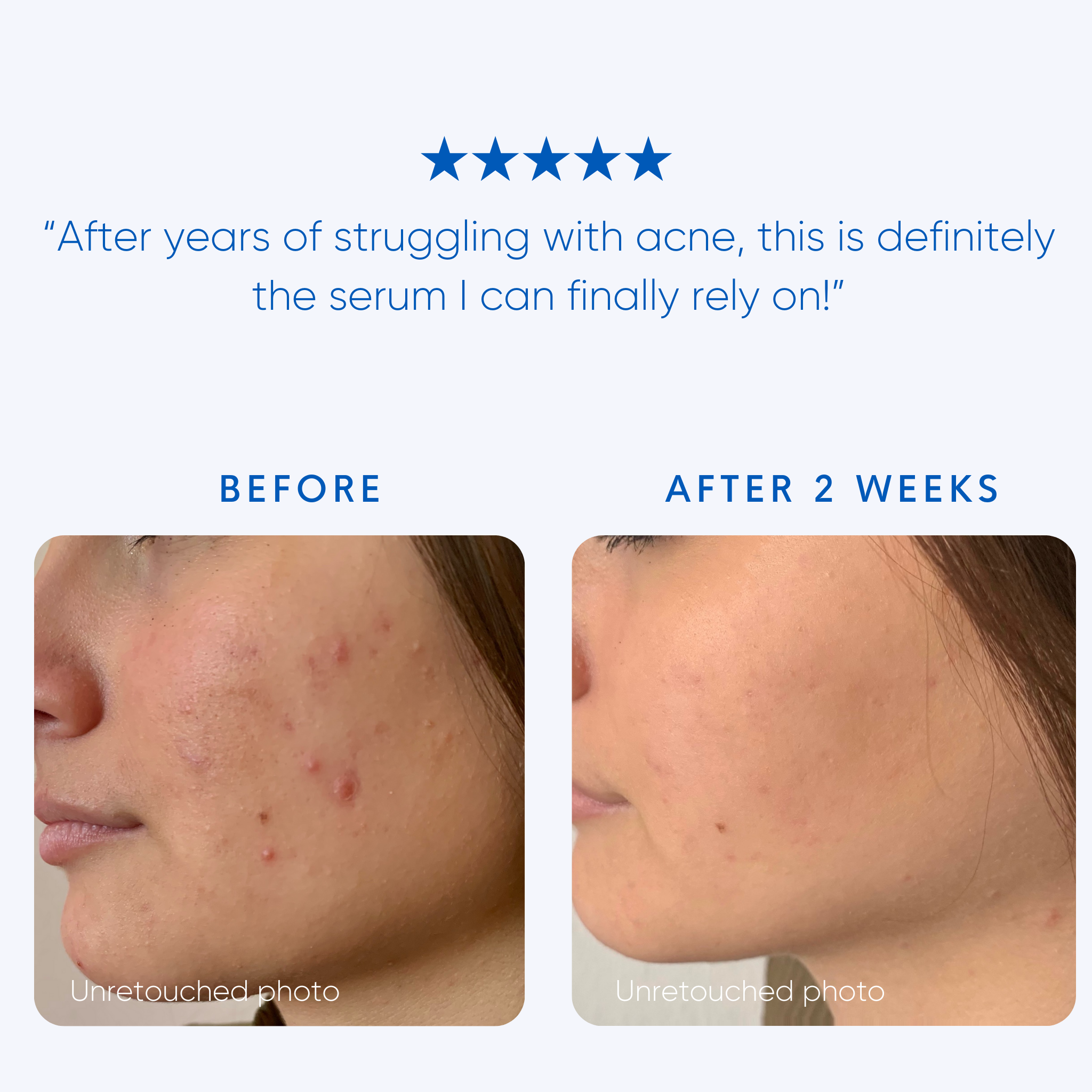 Albanian Immortelle Serum - Rescue Drops - Rena Roots™