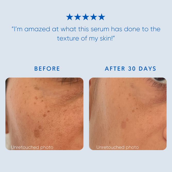 Afghan Rose – Rejuvenating Face Serum