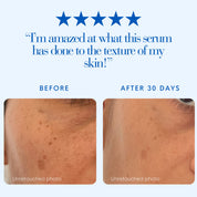 Before and after comparison of skin texture with a five-star rating and customer review text.