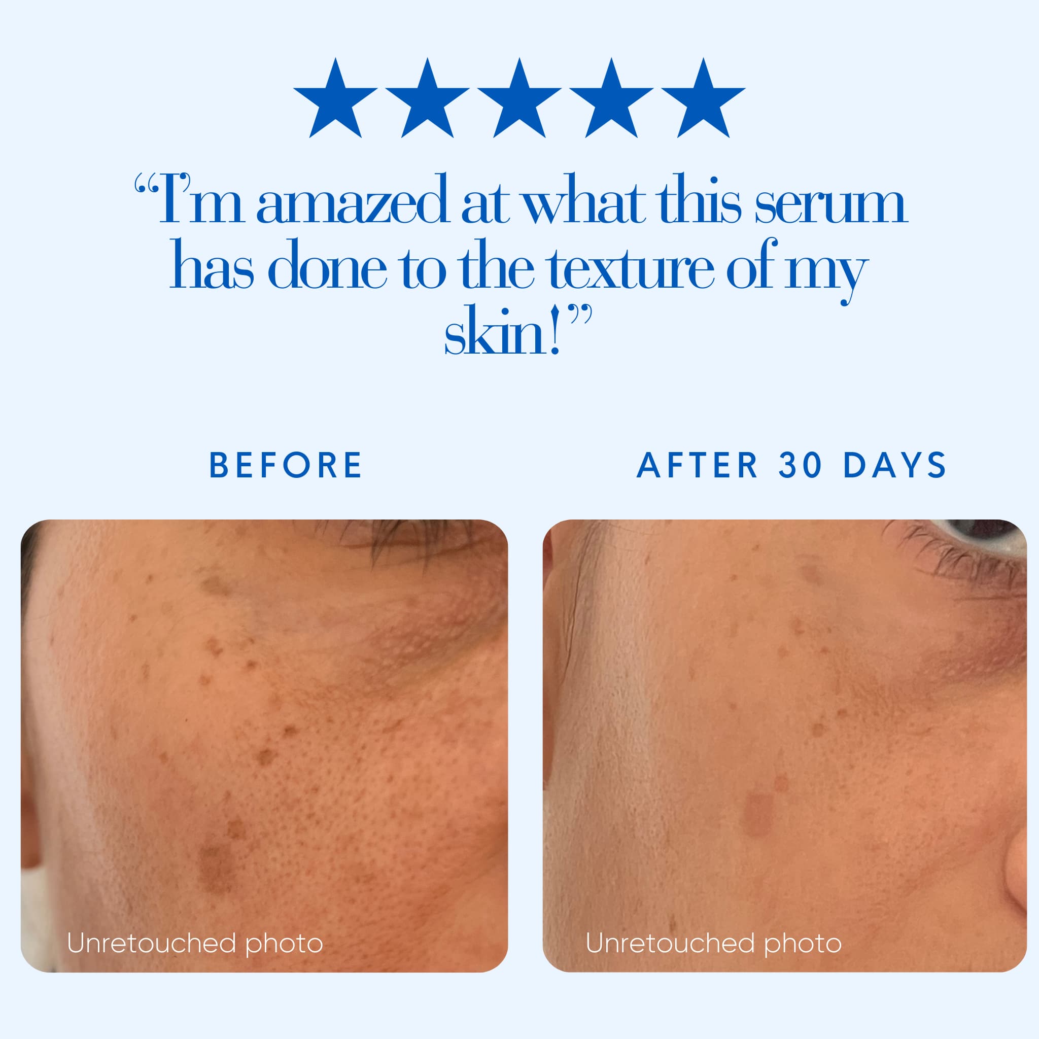 Before and after comparison of skin texture with a five-star rating and customer review text.